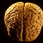 "Yeah, that's a brain," confirms everyone who looked at the brain this guy found on a beach