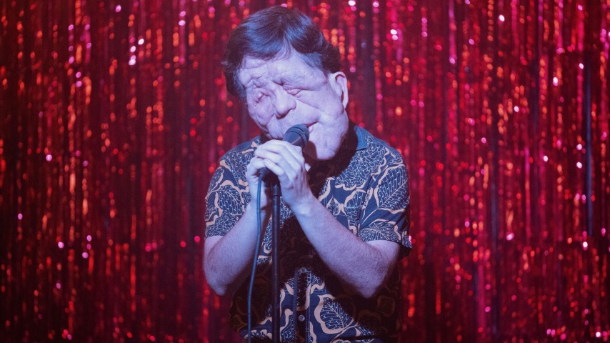 A Different Man's Adam Pearson to play Joseph Merrick in new Elephant Man adaptation
