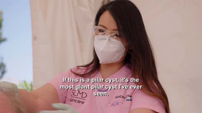 That's the Way the Pilar Cyst Bounces on Dr. Pimple Popper