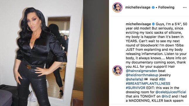 Michelle Visage Evicts Her 'Toxic Sacks of Silicone'