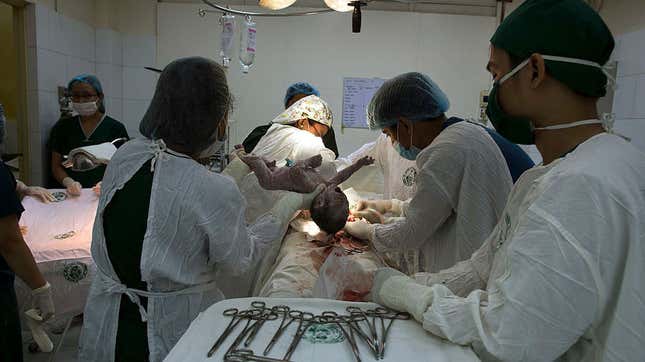 C-Section Stigma Is Contributing to Maternal Mortality