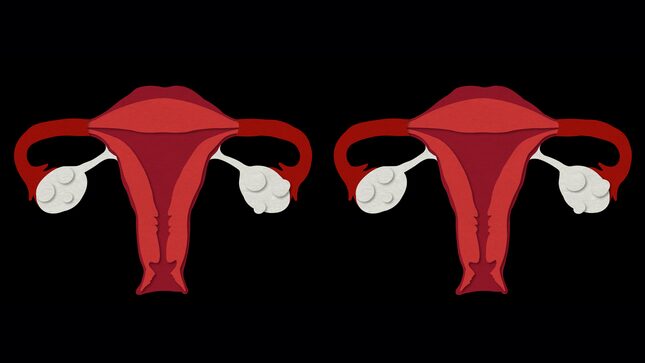 Woman Discovers She Has 2 Uteruses, 2 Cervixes, and Twins On the Way