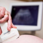 Charges Dropped for Woman Cruelly Accused of Murder After Giving Birth to a Stillborn