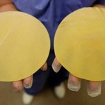 FDA Now Wants Textured Breast Implants to Be Recalled
