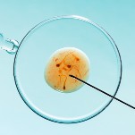 2 More Alabama Fertility Clinics Pause IVF After Court's Chilling Ruling