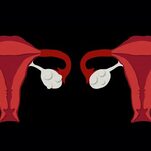 Woman Discovers She Has 2 Uteruses, 2 Cervixes, and Twins On the Way