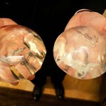 A Woman's Breast Implant Bounced Away a Bullet & Saved Her Life