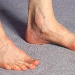 Anti-Vaxxers Are Harassing This Poor Woman Who Just Wants Treatment for Her Fucked Up Foot
