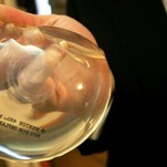 The FDA Chose Not to Ban Breast Implants Linked to Cancer and Autoimmune Problems