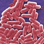 Very Fun Study Finds 1 in 3 Overseas Travelers Will Pick Up Drug-Resistant Bacteria