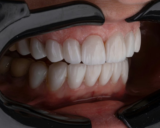 Rotting Teeth, Rotten System: What Your Smile Says About Inequality in America