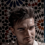 Hair Transplant : What Techniques Are Used in Turkey?